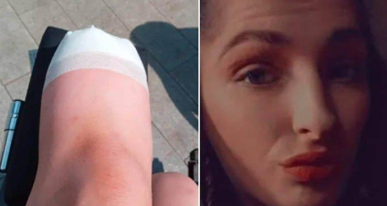 yeni aldigi ayakkabi hayatini karartti engelli kaldi hastane koridorlarina mahkum oldu uuGYST8T.jpg