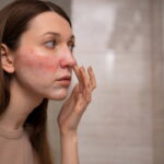 Cilt Bariyerinizi Zayıflatan 7 Belirti ve Koruma Yöntemleri